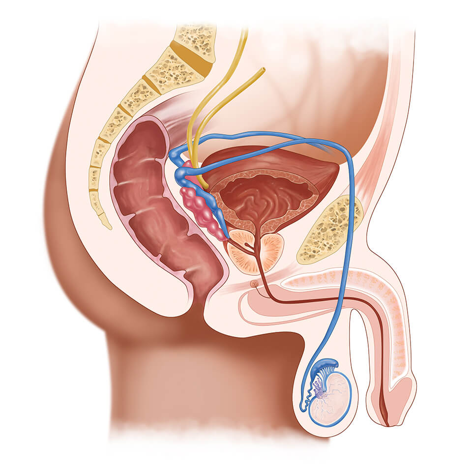 Vasectomy - Peak Medical Group