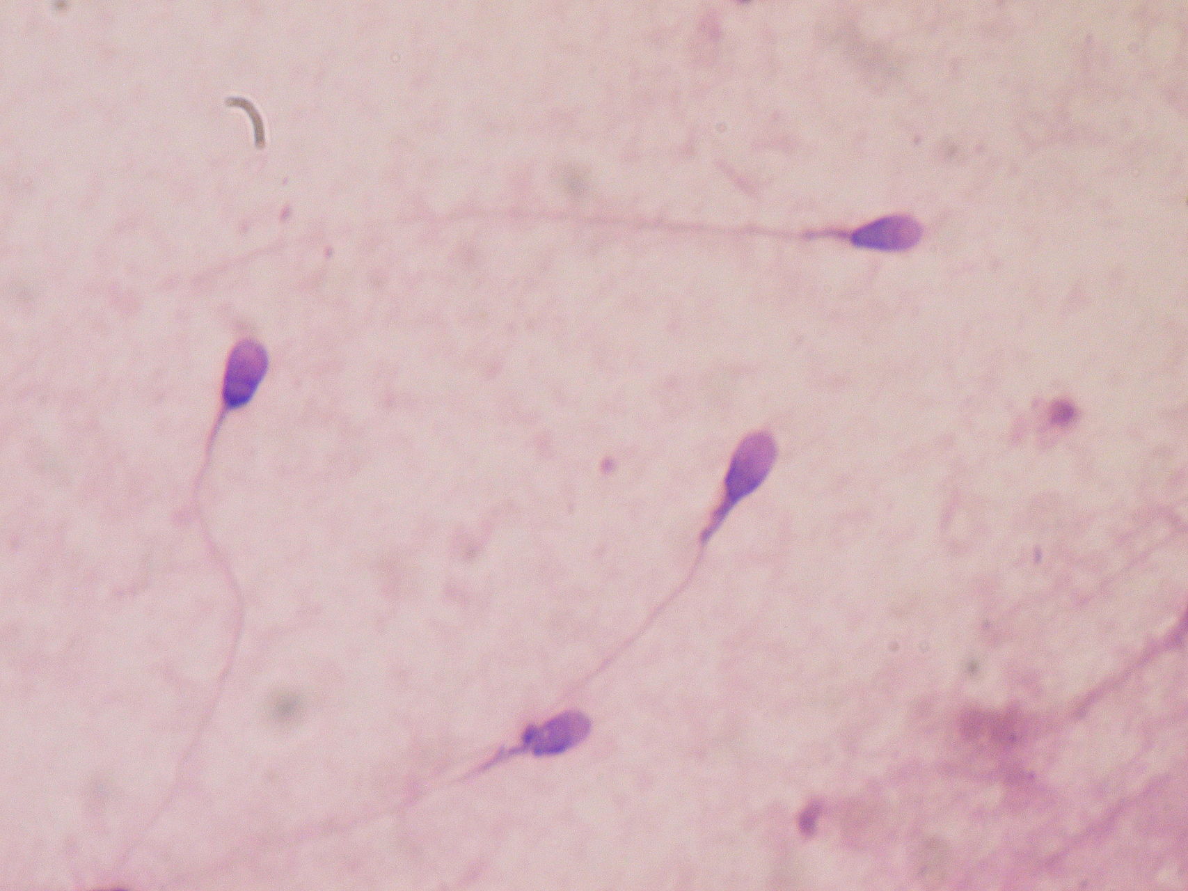 Sperm under the microscope