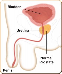 proscar and flomax after turp