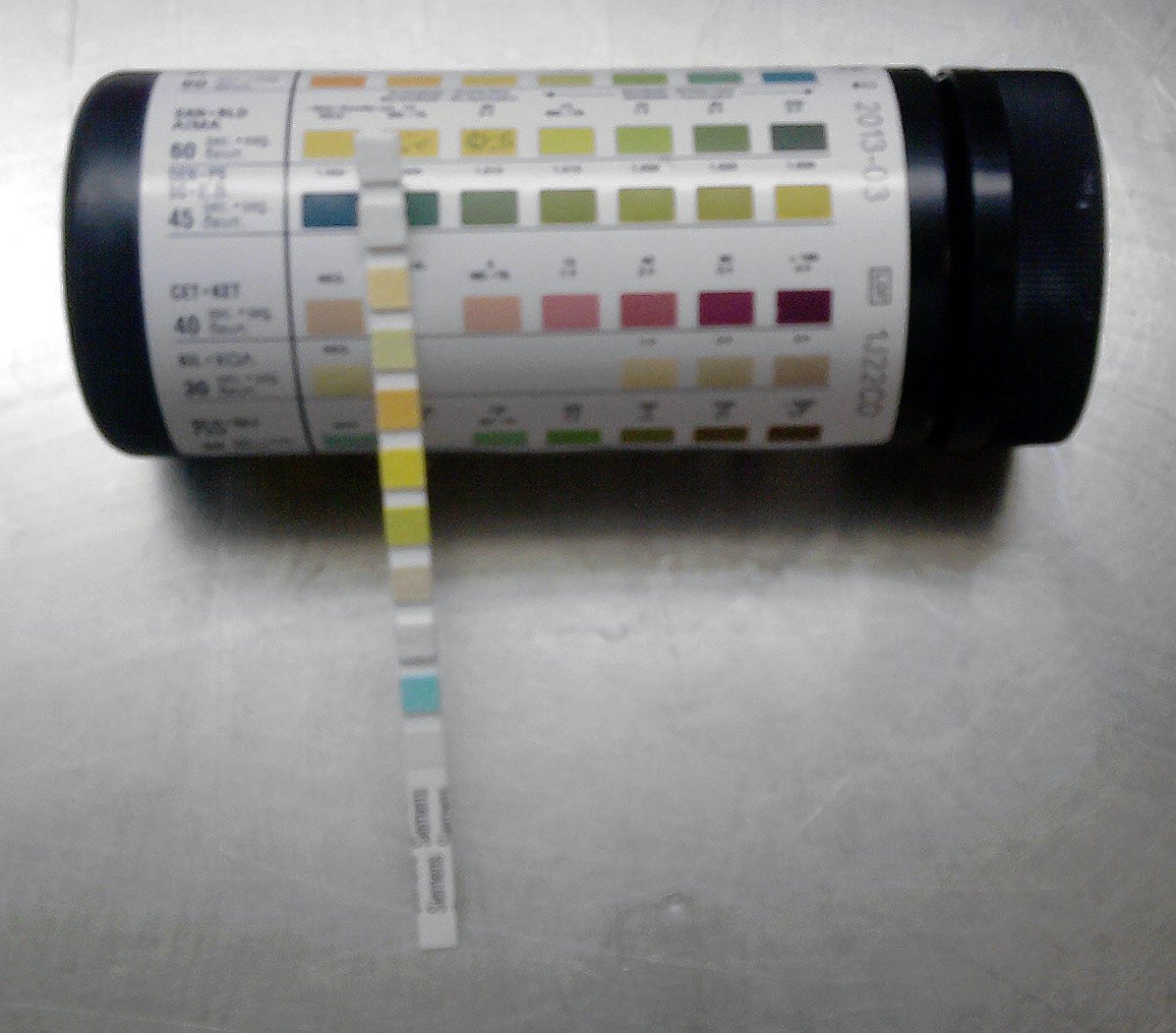 Urinalysis